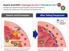 7 dari 10 Orang Indonesia Alami GERD, Fexuprazan Tawarkan Solusi Cepat dan Efektif untuk Gejala Malam Hari 7 dari 10 Orang Indonesia Alami GERD, Fexuprazan Tawarkan Solusi Cepat dan Efektif untuk Gejala Malam Hari