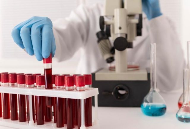 Cuma 50 Orang Punya! Kenalan Sama Golden Blood, Golongan Darah Langka di Dunia