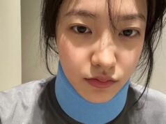 Yeri Red Velvet Cedera Saat Pilates, Tetap Bercanda di Tengah Proses Pemulihan Yeri Red Velvet Cedera Saat Pilates - sumber foto Instagram