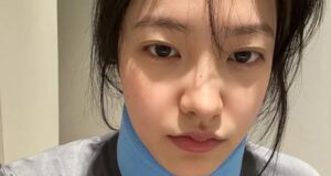 Yeri Red Velvet Cedera Saat Pilates, Tetap Bercanda di Tengah Proses Pemulihan Yeri Red Velvet Cedera Saat Pilates - sumber foto Instagram