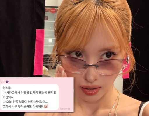 Bikin Kaget! Momo TWICE Tiba-Tiba Cabut Gigi di Tengah Tur Momo TWICE Tiba-Tiba Cabut Gigi di Tengah Tur - sumber foto IG/momo