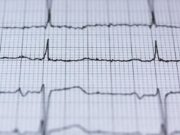 Tak Perlu ke Kota Besar, Kini Warga Kendal Bisa Cek Jantung Lewat Layanan EKG Tak Perlu ke Kota Besar, Kini Warga Kendal Bisa Cek Jantung Lewat Layanan EKG