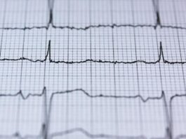 Tak Perlu ke Kota Besar, Kini Warga Kendal Bisa Cek Jantung Lewat Layanan EKG