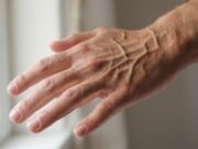 Urat Tangan Terlihat Menonjol Saat Nyetir? Ternyata Bisa Jadi Tanda Tubuh Sedang Bekerja dengan Baik urat-urat di tangan terlihat lebih menonjol - sumber foto istimewa