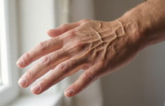 Urat Tangan Terlihat Menonjol Saat Nyetir? Ternyata Bisa Jadi Tanda Tubuh Sedang Bekerja dengan Baik urat-urat di tangan terlihat lebih menonjol - sumber foto istimewa